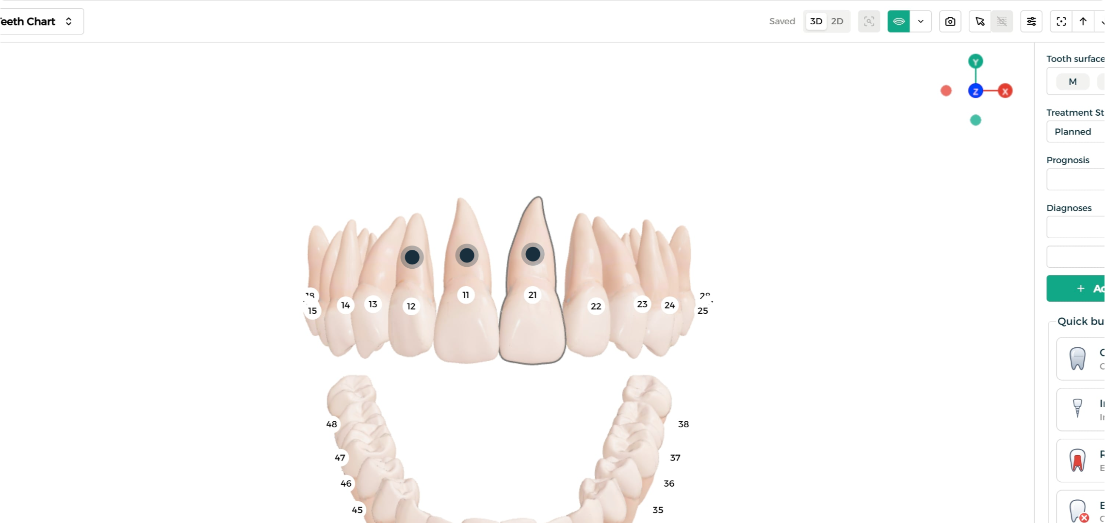Step 5 - Multiple teeth selected together