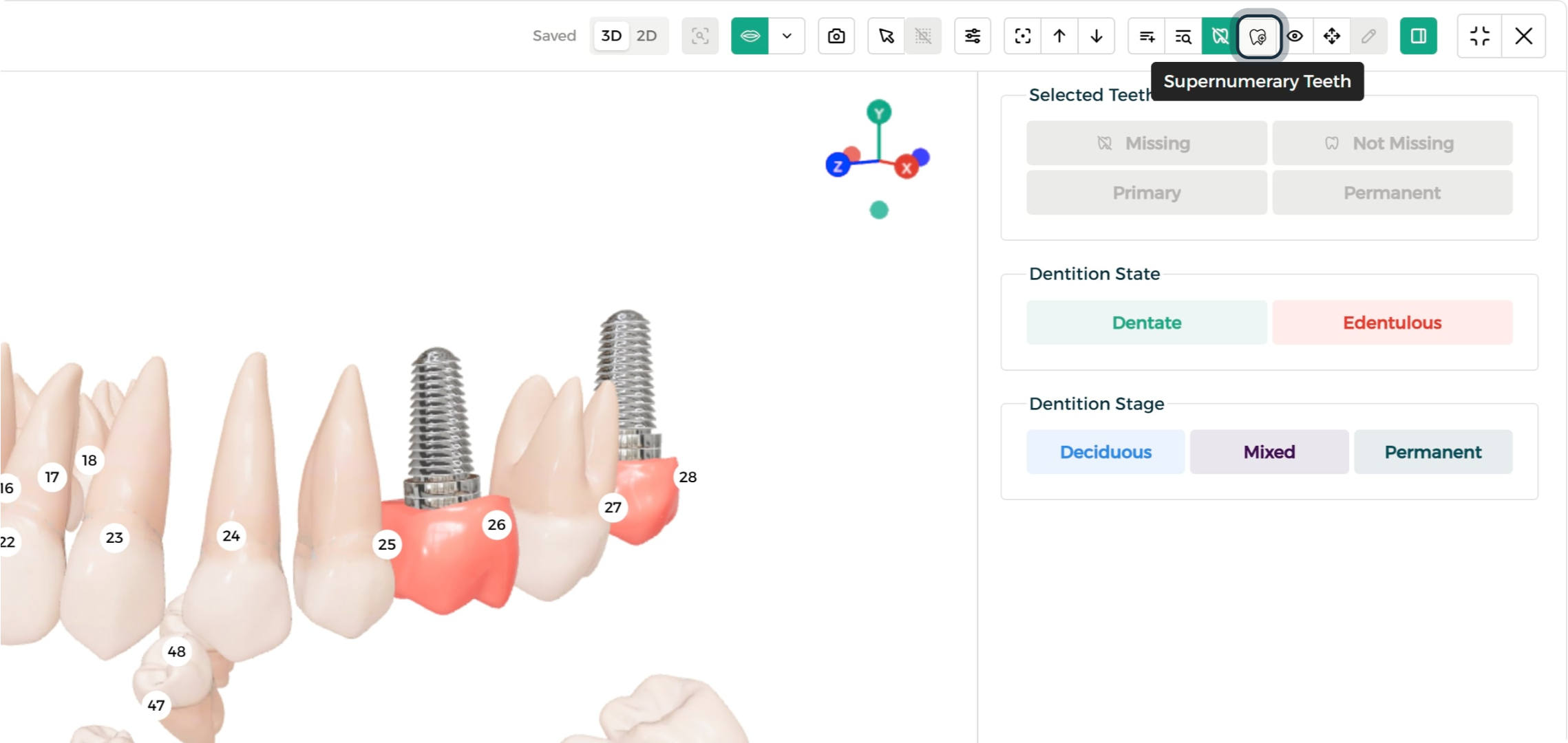 Step 1 - Supernumerary Tooth tab
