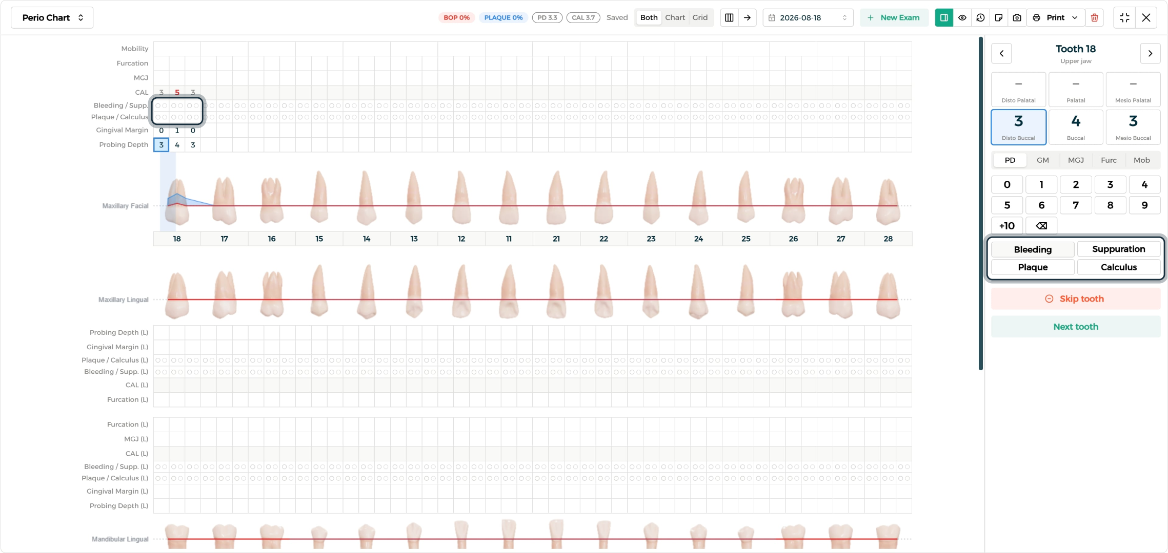 Step 1 - Clinical surface indicators